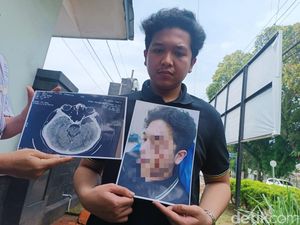 Babak Baru Kasus Taruna Akmil Diduga Aniaya Mahasiswa UISU