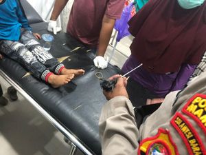 Balita 4 Tahun di Mamuju Dipanah OTK saat Dibonceng Ortu, Polisi Selidiki