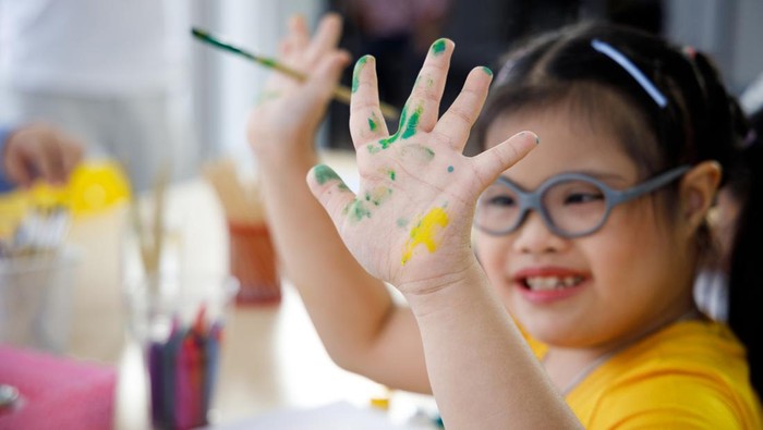 Ilustrasi Anak dengan Down Syndrome