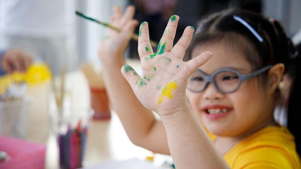 Ilustrasi Anak dengan Down Syndrome