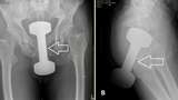 Viral Dumbell Masuk Dubur Dinarasikan Ini Indonesia, Faktanya Begini