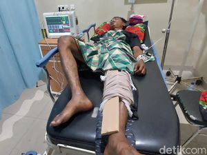 Polisi: Peluru Nyasar Kenai Pemuda Bandar Lampung Bukan dari Geng Motor