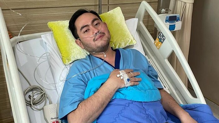 Akibat Kelelahan, King Nassar Dirawat di RS hingga Gunakan Alat Bantu Pernapasan