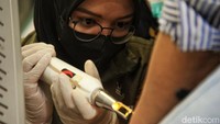 Tato dihapus menggunakan sinar laser.