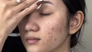 Viral Wanita Berjerawat Dirias ala Pengantin China, Hasilnya bak Ariel Tatum