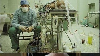 Dr. Religa Memantau Vital Pasiennya Setelah Menyelesaikan Transplantasi Jantung Selama 23 Jam. Asistennya Tidur Di Pojok. 1987 Foto: Facebook.com/oldpictures32