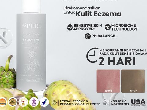 Rekomendasi body lotion lokal dari Npure. Rekomendasi body lotion lokal dari Npure.