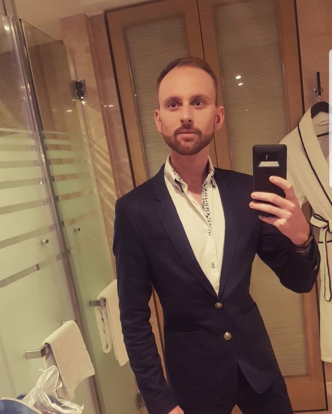 Begini penampilannya sebelum melakukan perawatan hair system.Foto: Instagram Ashley Tawney