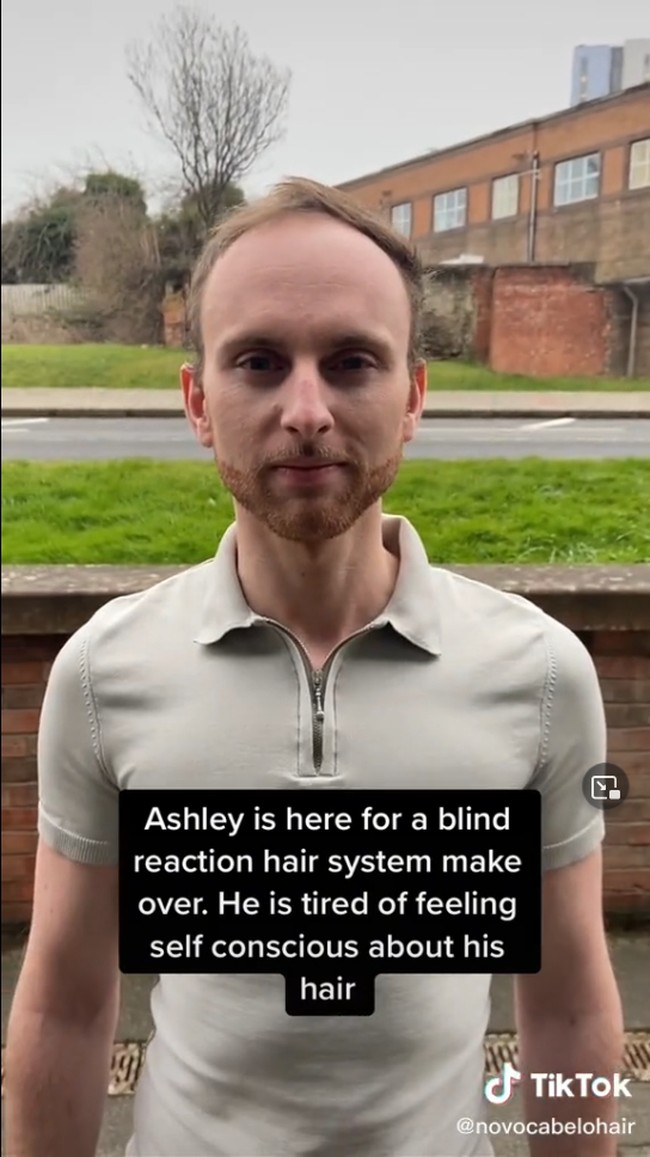 Seorang pria berusia 20an bernama Ashley Tawney sudah mengalami penipisan rambutnya yang membuat penampilannya tampak lebih tua. Karena itu, Ashley menjalani perawatan yang sukses membuatnya pangling.Foto: TikTok Nova Cabelo