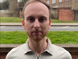 Transformasi Viral Pria Dulu Pitak Kini Lebat, Jadi Kebanjiran Ajakan Kencan