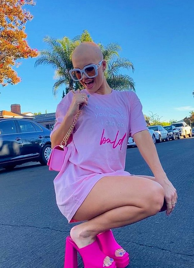 Pada 2019, kepercayaan dirinya kembali. Dia pun mengikuti casting untuk model. Foto: dok. Instagram/@christie.valdiserri