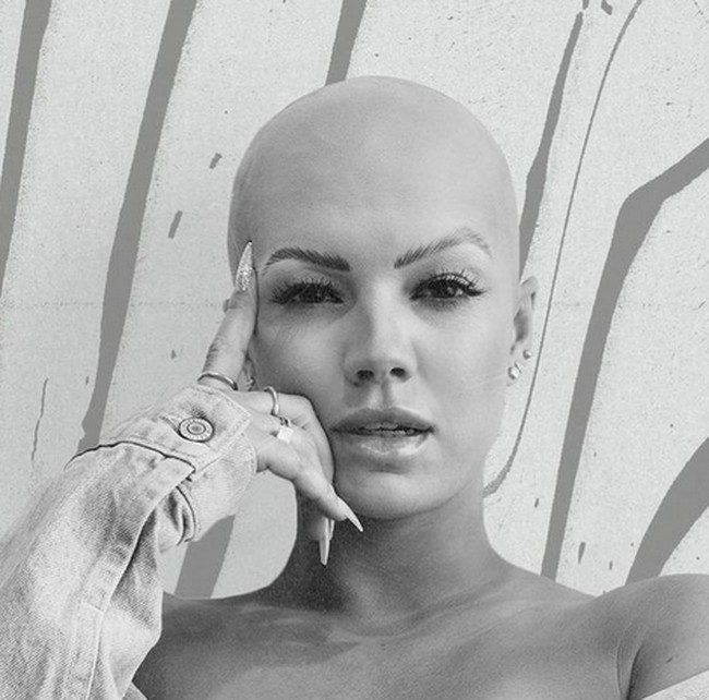 Christie Valdiserri pertama kali menyadari rambutnya rontok hingga pitak pada 2016. Setahun kemudian rambutnya menjadi rontok dengan sangat cepat. Foto: dok. Instagram/@christie.valdiserri