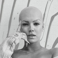 Christie Valdiserri pertama kali menyadari rambutnya rontok hingga pitak pada 2016. Setahun kemudian rambutnya menjadi rontok dengan sangat cepat. Foto: dok. Instagram/@christie.valdiserri