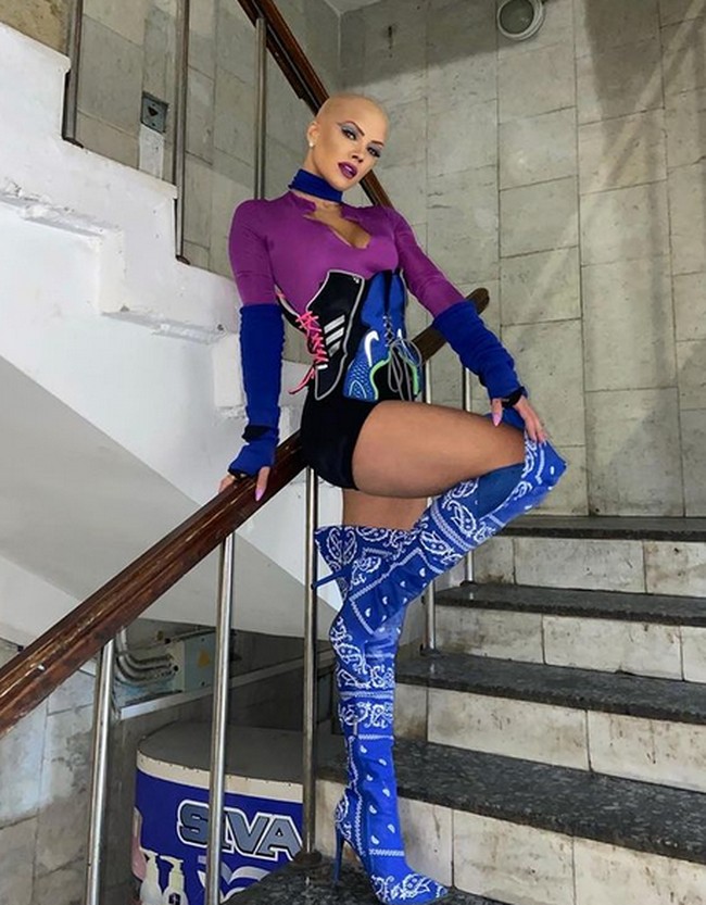 “Itu adalah pengalaman yang sangat traumatis. Aku kehilangan semua rambutku, aku tidak punya pekerjaan dan aku bukan lagi mahasiswi berambut pirang dan populer,” ungkap Christie, seperti dikutip dari Daily Star. Foto: dok. Instagram/@christie.valdiserri