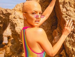 Foto: Penampilan Model Botak, Dulu Malu Kini Bersyukur