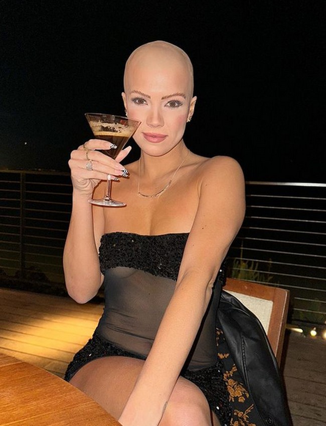 Kini, Christie merasa bersyukur dengan penampilan botaknya. Kepala botaknya menjadi keunikannya. Foto: dok. Instagram/@christie.valdiserri