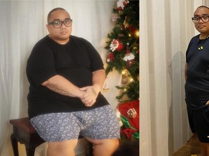 Sempat Dialami Saykoji, Ini Saran Psikolog buat Cegah Kebiasaan Emotional Eating