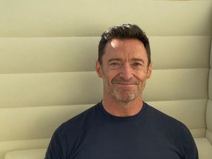 Hugh Jackman Curhat Alami Gejala Mirip Kanker Kulit, Begini Kondisinya