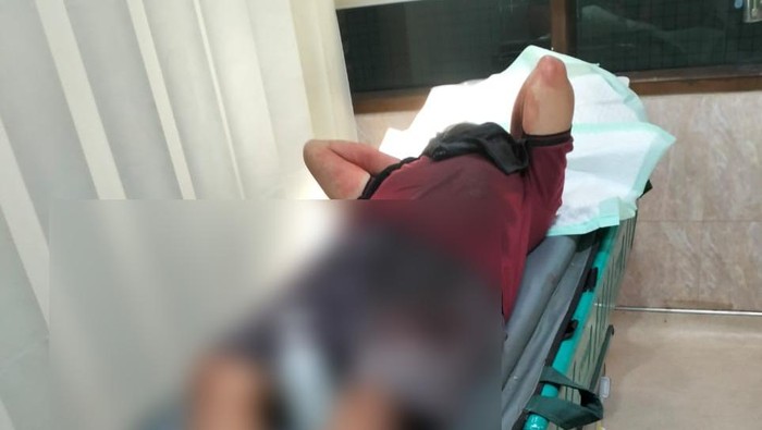 Korban pembacokan di Pasuruan