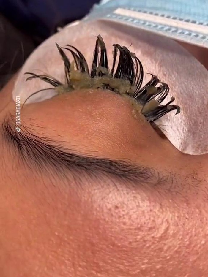 Eyelash extension