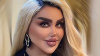 7 Foto Wanita Irak 43 Kali Operasi Plastik Demi Jadi Barbie di Dunia Nyata