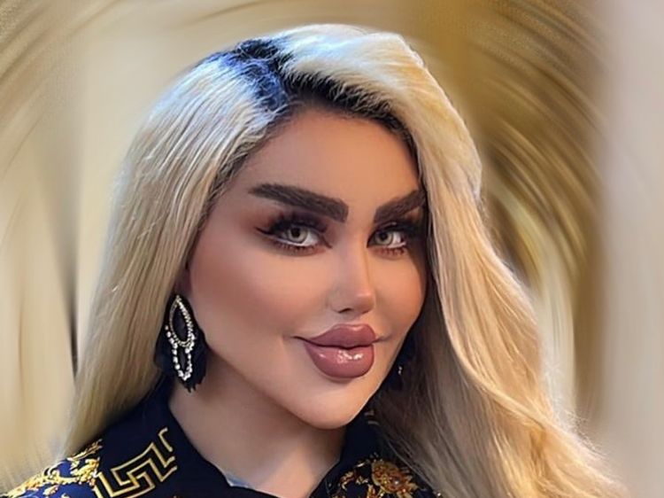 Potret Wanita Irak Rela Oplas 43 Kali demi Jadi Barbie di Dunia Nyata