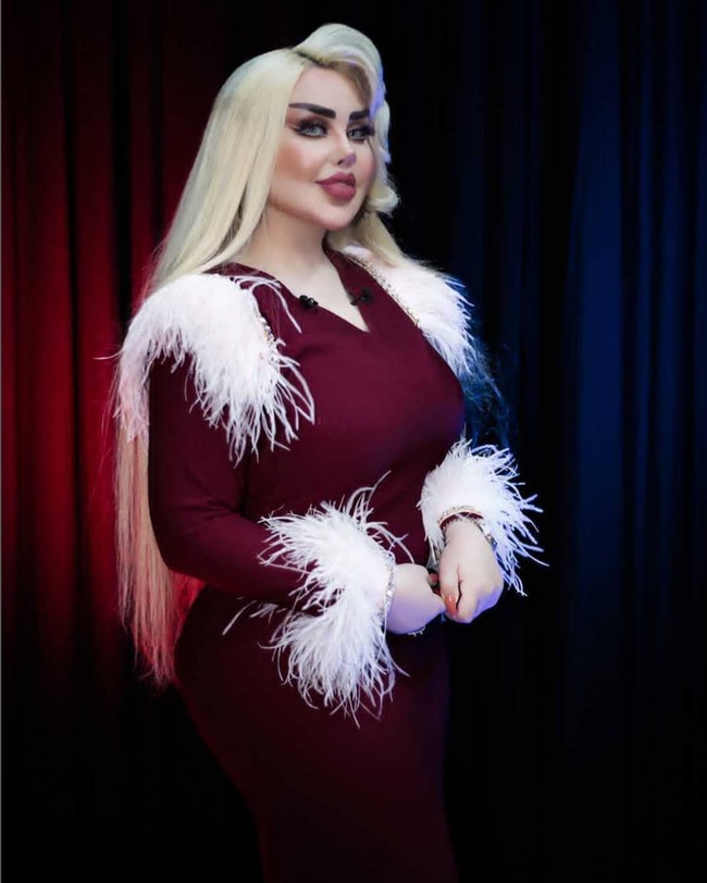 Selain operasi plastik, wanita 29 tahun ini juga rutin suntik filler untuk mempertahankan wajah Barbie yang dinginkannya. Foto: Instagram/@dalia_naim1