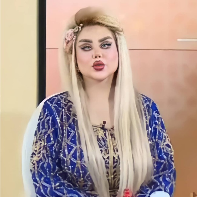 Hujatan demi hujatan tak menghentikan Dalia Naeem untuk terus tampil bak Barbie di dunia nyata. Lewat akun Instagram dengan 996 ribu followers, dia tetap membagikan aktivitas dan foto dirinya yang sudah operasi plastik. Foto: Instagram/@dalia_naim1