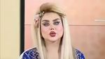 Potret Wanita Irak Rela Oplas 43 Kali demi Jadi Barbie di Dunia Nyata