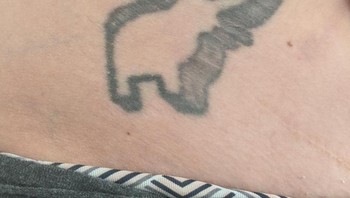 Tato berubah jadi bekas stretch mark. Foto: Brightside