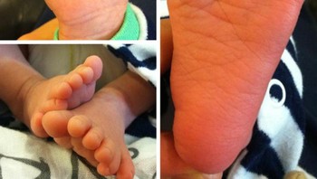 Bayi ini punya 12 jari kaki dan tangan. Foto: Brightside