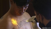 Kegiatan ini dimanfaatkan warga untuk menghapus tato secara cuma-cuma.