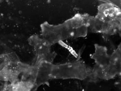 Foto Menakjubkan Terlihat Melalui Mikroskop