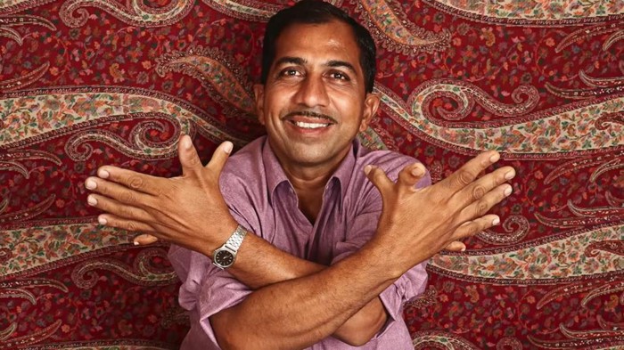 Devendra suthar memegang rekor sebagai manusia dengan jari terbanyak di dunia. Ia mengidap kelainan genetik polidaktili. Begini 6 potretnya.