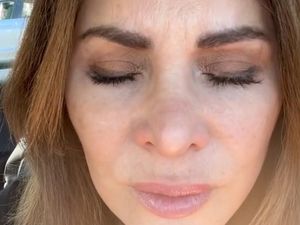 Penampilan Wanita yang Berhenti Suntik Botox Setelah 20 Tahun, Jadi Begini