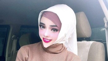 Hasil editan bikin dagunya mungil.  haFoto: Boredpanda 