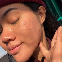 Bahkan dalam salah satu unggahannya terlihat Yura Yunita yang memamerkan kondisi wajahnya yang berjerawqt saat di Jepang. Wow jerawat mendadak bermuntjulan manja saat perjalanan ke luar kota  Siapa disini yang juga lagi struggle sama jeriwititiw? Angkat tangannya... tulis keterangan dalam unggahan tersebut. Foto: Instagram/@yurayunita