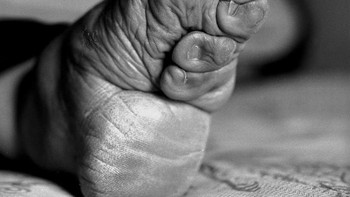 Selama hampir seribu tahun, gadis-gadis kecil di China membalut kaki mereka dengan erat dengan perban dengan harapan dapat menghentikan pertumbuhan kaki. Hal ini menyebabkan jari-jari kaki mereka melengkung dan kaki mengerut pada diri mereka sendiri dan menciptakan ilusi kaki mungil padahal mereka sebenarnya hanya merusak dan melumpuhkan diri mereka sendiri dan anak-anak mereka. Foto: Onedio