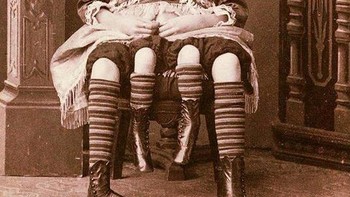 Josephine Myrtle Corbin adalah seorang penampil di Amerika. Dia terlahir sebagai dipygus. Artinya, poros tubuhnya terbelah saat sedang berkembang dan sebagai hasilnya menumbuhkan dua panggul terpisah, diposisikan berdampingan. Dia juga memiliki empat kaki, setiap kaki luar dipasangkan dengan kaki bagian dalam yang lebih kecil. Kendati dia bisa menggerakkan kaki dalamnya, namun terlalu lemah untuk berjalan. Foto: Onedio