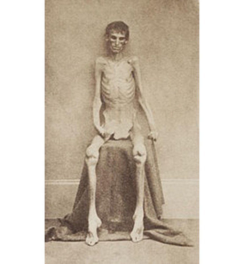 Foto Jadul Menyeramkan Bikin Merinding