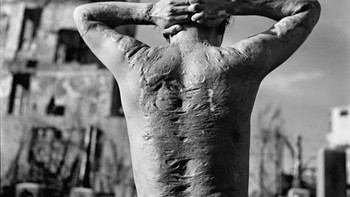 Foto penyintas bom Hiroshima. Foto: Onedio