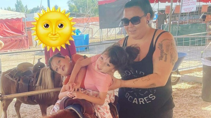 Potret kembar siam yang bertahan hidup hingga berusia 6 tahun.