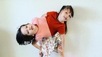 Callie dan Carter memiliki jantung dan perut sendiri-sendiri. Namun, mereka harus berbagi saluran usus, hati, dan kandung kemih. Mereka juga hanya bisa mengendalikan kedua lengan dan satu kaki. “Anatomi Callie dan Carter seperti dua gelombang yang bertabrakan,” kata Chelsea Torres kepada KTVB baru-baru ini, dikutip dari Daily Mail UK pada Sabtu (8/4/2023). (Foto: Instagram @callieandcarterbeatodds)