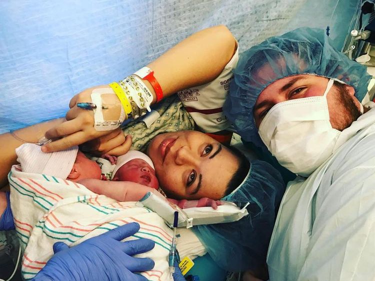 Potret Kembar Siam Satu Tubuh, Sempat Divonis Tak Bakal Bisa Hidup Lama