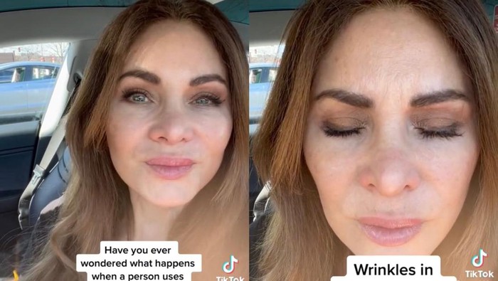 Viral Wanita Stop Suntik Botox Setelah 20 Tahun, Begini Penampilannya
