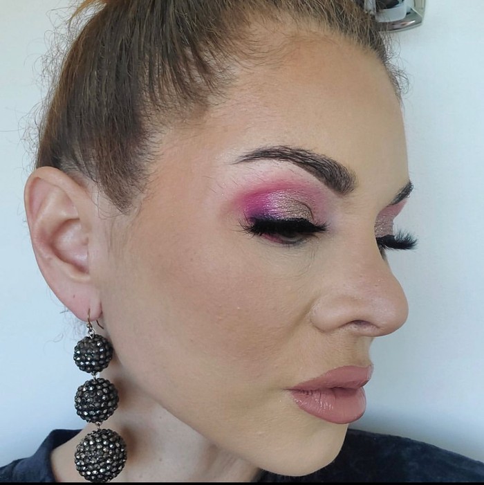 Potret Wanita yang Stop Suntik Botox Setelah 20 Tahun, Begini Perubahannya