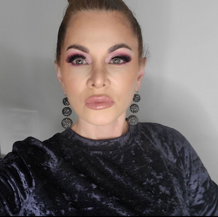 Potret Wanita yang Stop Suntik Botox Setelah 20 Tahun, Begini Perubahannya