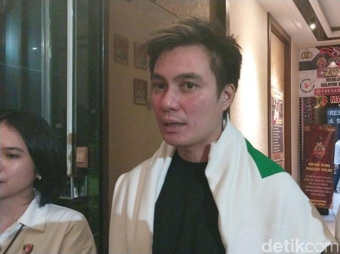 Baim Wong usai diperiksa di Polda Sumut.