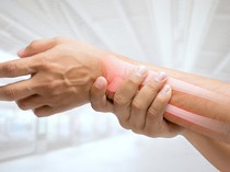 Alami Patah Kaki, Ini Pertolongan Pertama dan Tips dari Dokter