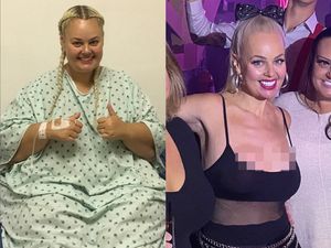 Terinspirasi Barbie, Wanita Ini Diet Hingga Berat Badan Turun 90 Kg